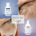 Cradle Cap Combo