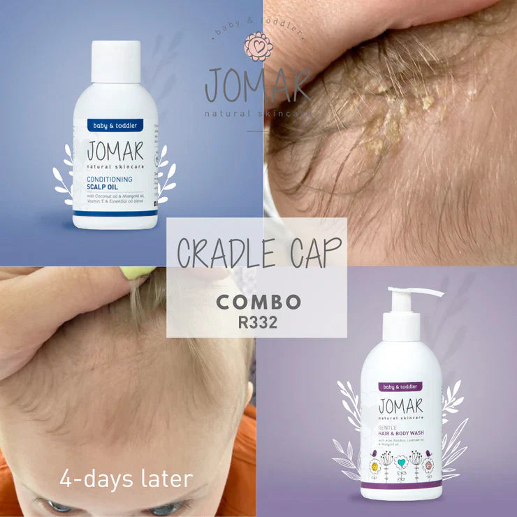Cradle Cap Combo