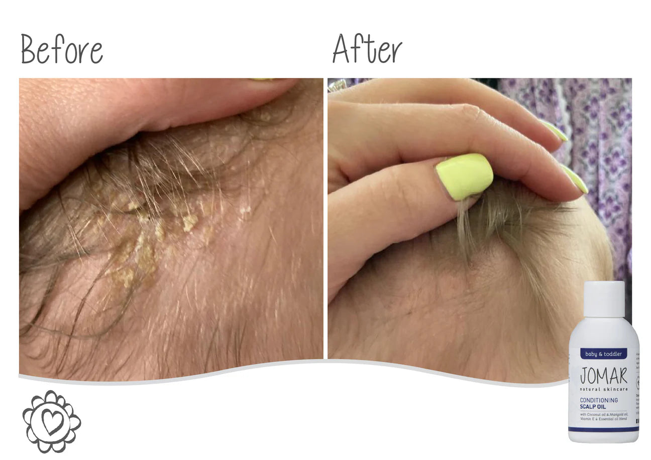 Conditioning Scalp Oil